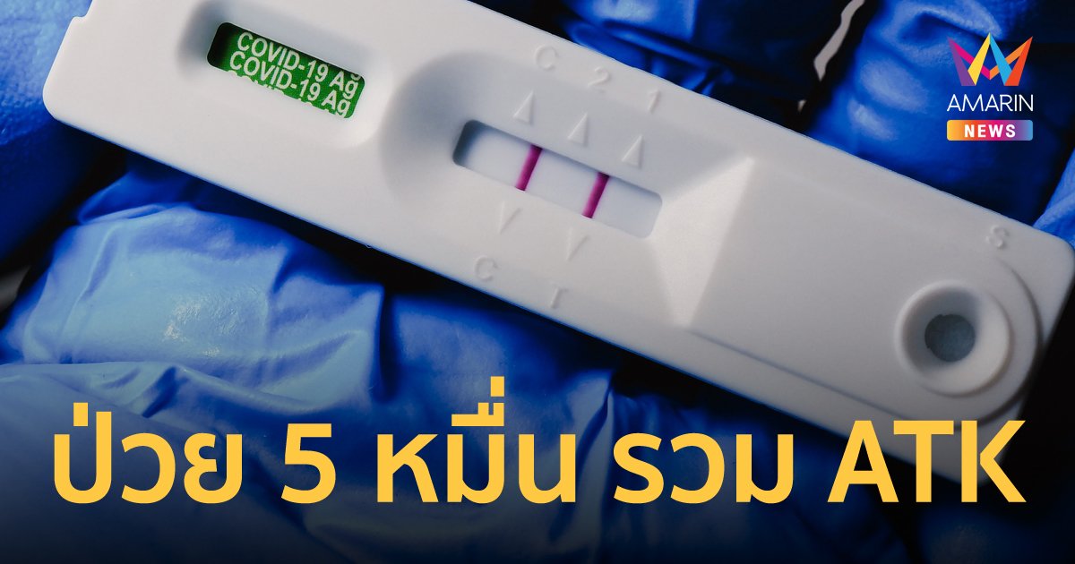 โควิดวันนี้ 30 มี.ค. 65 ป่วยใหม่ 25,389 ราย ติดเชื้อเข้าข่าย (ATK) 25,397 ราย เสียชีวิตเพิ่ม 87 คน