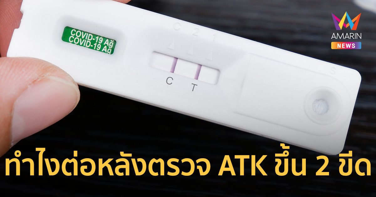 ตรวจ ATK แล้วขึ้น 2 ขีด ติดเชื้อโควิด สปสช. แนะให้ทำขั้นตอนตามนี้