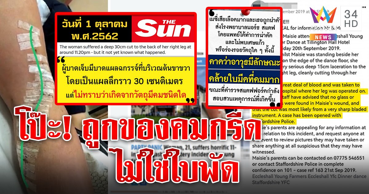 พลาด! แถลงแผลขาแตงโมเทียบต่างชาติไม่ได้ถูกใบพัด อมรินทร์พิสูจน์เป็นนักศึกษาถูกของคมกรีด (คลิป)