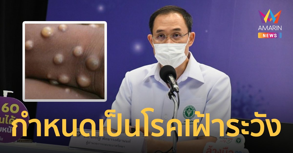 สธ. กำหนด "ฝีดาษลิง" เป็นโรคติดต่อเฝ้าระวัง ยืนยันยังไม่พบรายงานในไทย