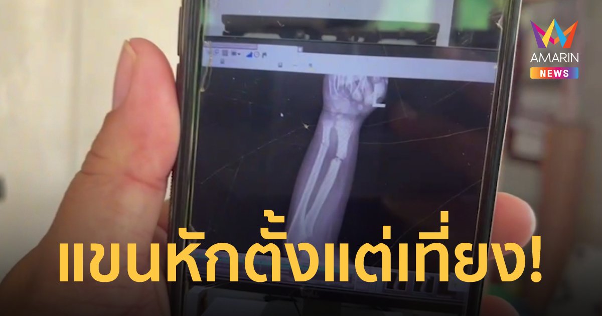 อาช็อก หลาน 5 ขวบ แขนหักกลับบ้าน ครูเบี้ยวค่าเยียวยาถ้าอยากได้ต้องฟ้อง