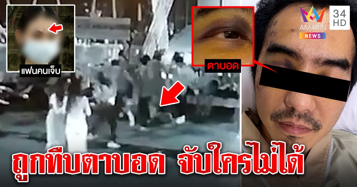 หนุ่มซวยเจอแก๊งโจ๋ปริศนาดักซ้อมกะโหลกร้าว-ตาบอด แฟนเข้าช่วยเจ็บด้วย พ้อคลิปชัดแต่ตร.ไม่จับ (คลิป)