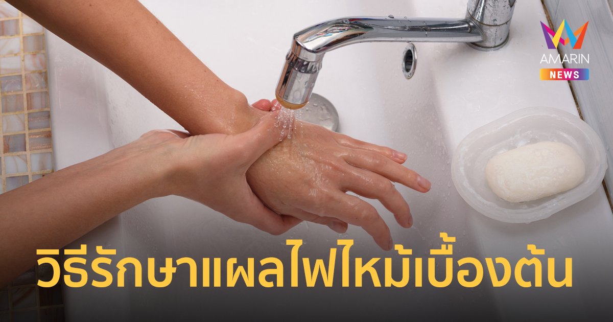 รักษาแผลจากไฟไหม้ แผลพุพอง น้ำร้อนลวก อย่างไรให้ถูกวิธีไม่ติดเชื้อ