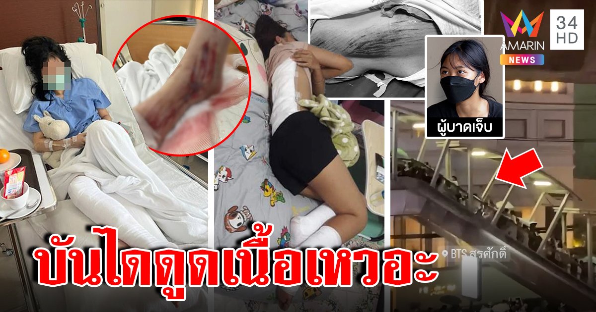 2 สาวเดินไม่ได้ บันไดเลื่อน BTS ดูดเนื้อเหวอะ ช็อกรองเท้ายังกระจุย ไร้คนเยียวยา (คลิป)