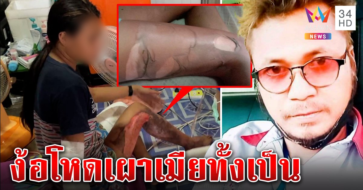 ง้อไม่คืนดี! ผัวเก่าราดน้ำมันจุดไฟเผาลูกเมียทั้งเป็น เผยนาทีบีบใจแม่เสี่ยงตายปกป้อง (คลิป)