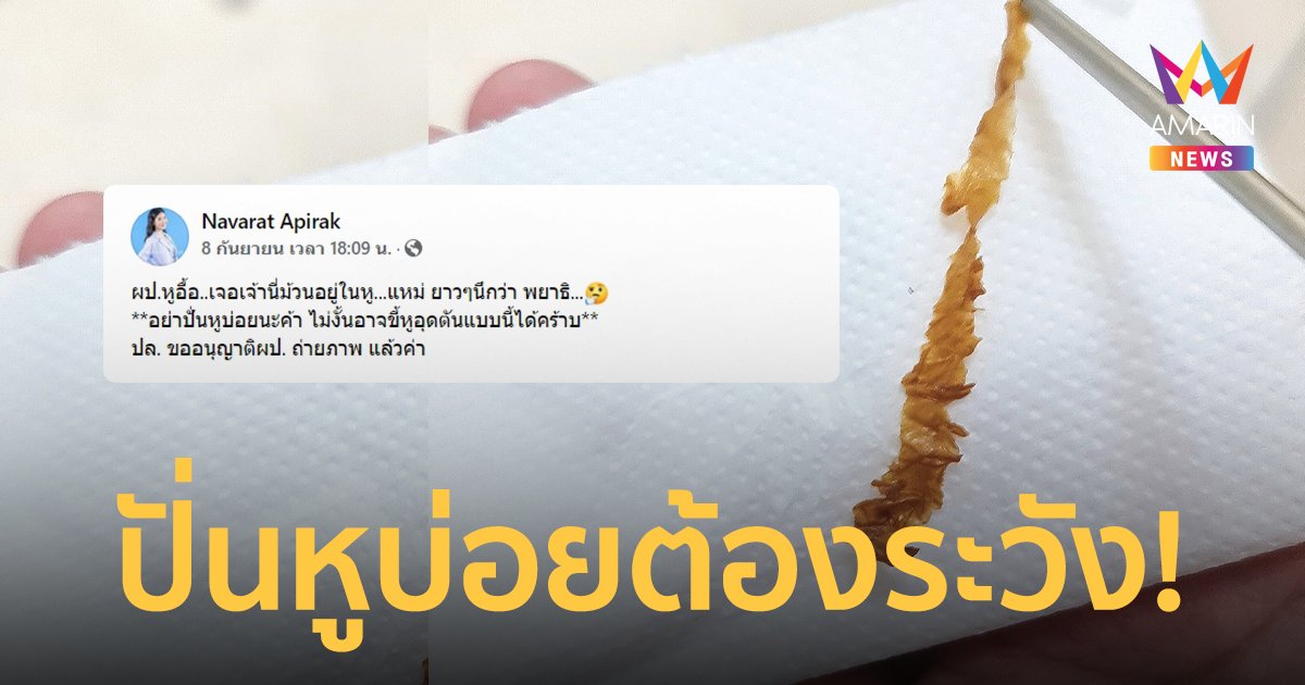 หมอเตือนคนชอบ "ปั่นหู" เจอขี้หูอุดตัน ม้วนเป็นแผ่นยาวคล้ายพยาธิ