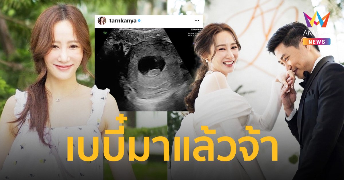 “ตาล กัญญา” ประกาศข่าวดี กำลังตั้งท้องลูกคนแรกแล้ว
