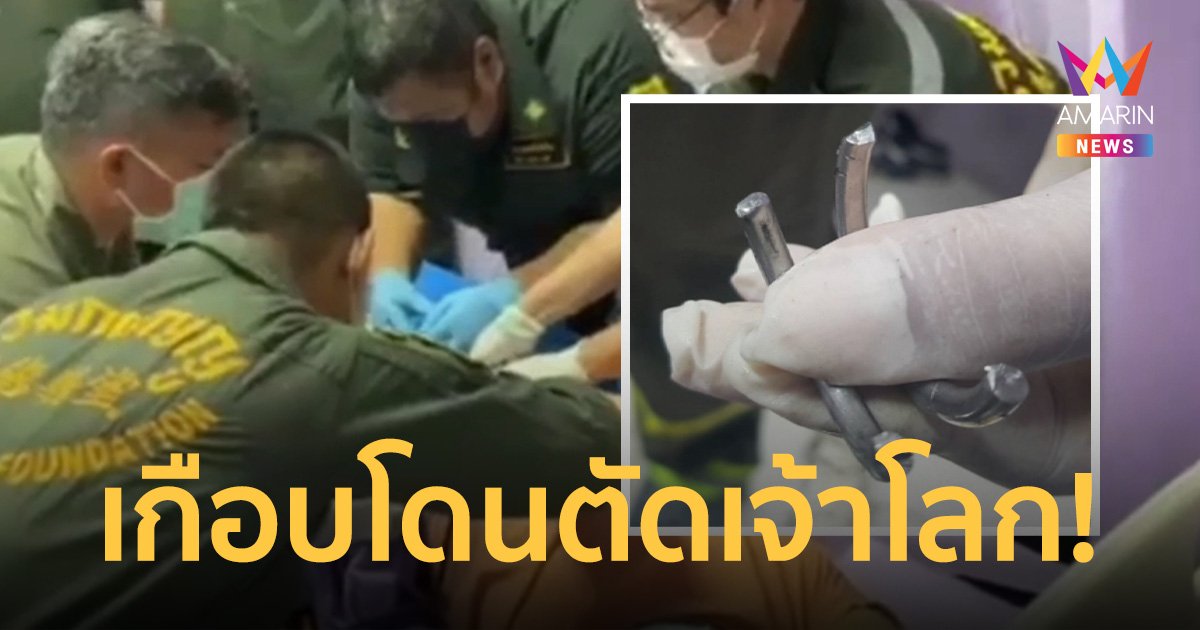 อุทาหรณ์ หนุ่มใส่ห่วงเหล็กรัดเจ้าโลกนาน 4 ปี เกิดอักเสบหวิดโดนเฉือน
