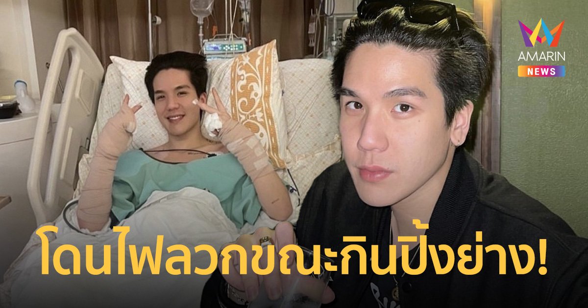 “มิว MEYOU” โดนไฟลวกขณะกินปิ้งย่าง! ต้องอยู่ ICUห้องปลอดเชื้อ