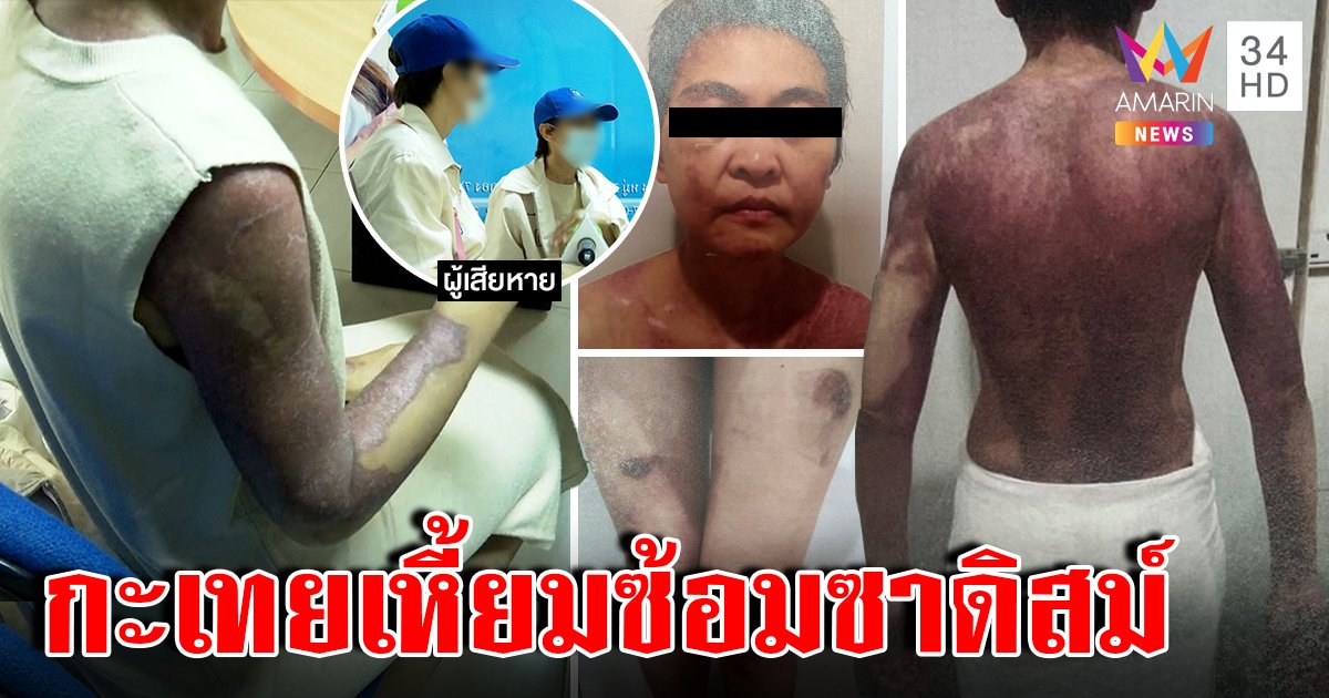 โคตรซาดิสม์! เหยื่อฮารุแฉโดนเตารีดนาบ เสี้ยมลูกชังแม่ เผยเหตุ 3 ปีไม่หนี (คลิป)