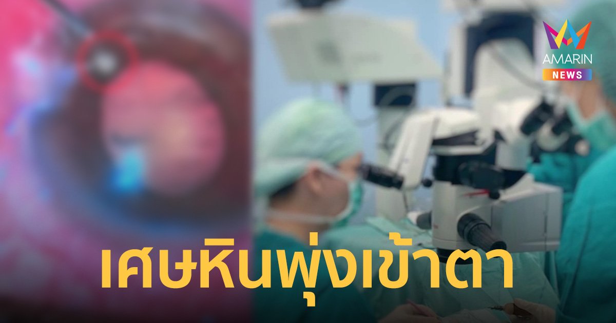 ชายวัย 50 ใช้เครื่องตัดหญ้าไม่ป้องกัน เศษหิน พุ่งทะลุกระจกตา