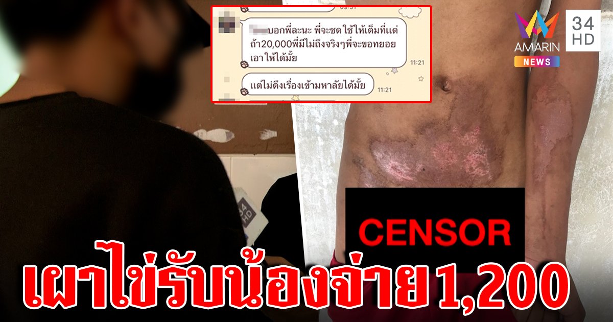 รับน้องวิปริต! รุ่นพี่พ่นไฟเผาขนเพชรปี 1 เหวอะครึ่งท่อน ลาออกรับเงินช่วยพันสอง (คลิป)
