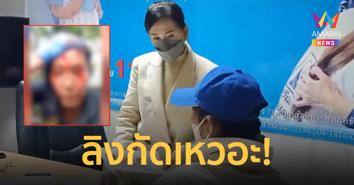 ลูกจ้างสวนสัตว์ร้อง "ปวีณา" ถูกลิงป่ากัดเหวอะถึงกะโหลก ไร้เหลียวแล