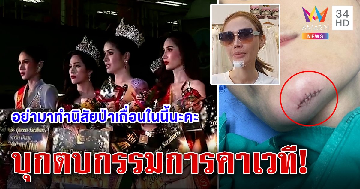 เดือดตบสนั่นเวทีสาวสอง ผู้สนับสนุนคางแตกงงไปทำอะไรให้ ผู้จัดแจงปมแย่งซีนเถื่อน (คลิป)