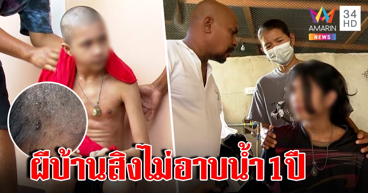 เหลือเชื่อเด็ก 14 ไม่อาบน้ำ 1 ปีเหาไต่ทั้งหัว หมอปลากล่อมแปลงโฉม (คลิป)