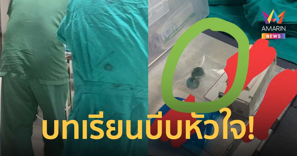 แม่โพสต์เตือนภัย! ลูกน้อยเผลอกิน"เบบี้คริสตัล" อุดตันลำไส้เข้าไอซียู
