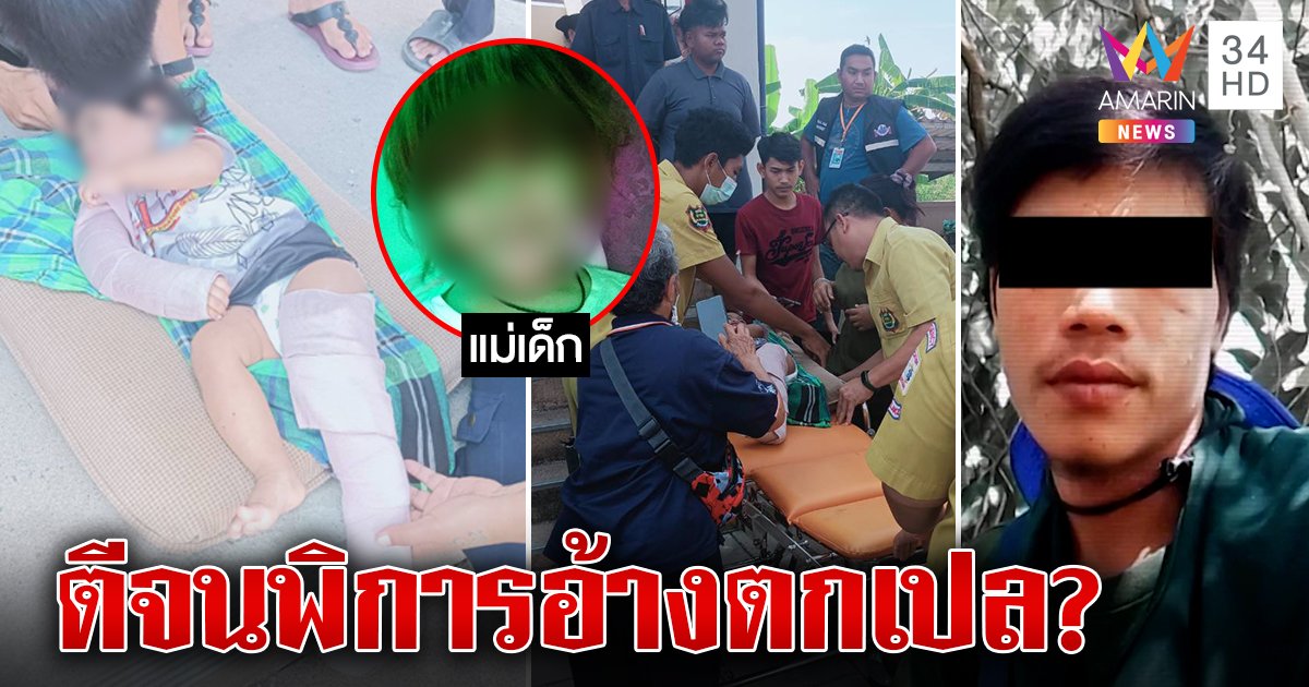 พ่อเลี้ยงโหดซ้อมเด็กขวบเศษแขนขาหัก แม่เบลอป้องผัวใหม่ตีลูกร้องหิว (คลิป)