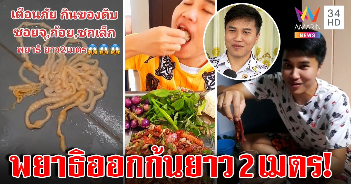 อย่าหาทำ! หนุ่มกินซอยจุ๊อึ้งถ่ายพยาธิโผล่ 2 เมตร หมอเตือนอันตรายแนะกินสุก (คลิป)