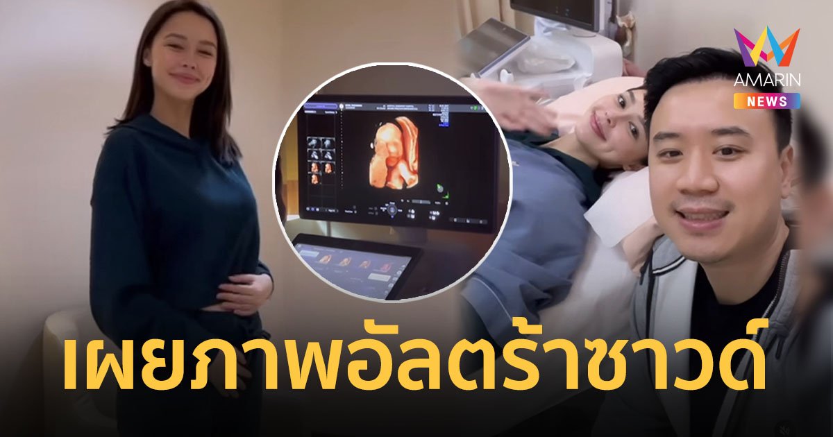 “แพทริเซีย” สุดตื่นเต้น เผยภาพอัลตร้าซาวด์โฉมหน้าลูกครั้งแรก