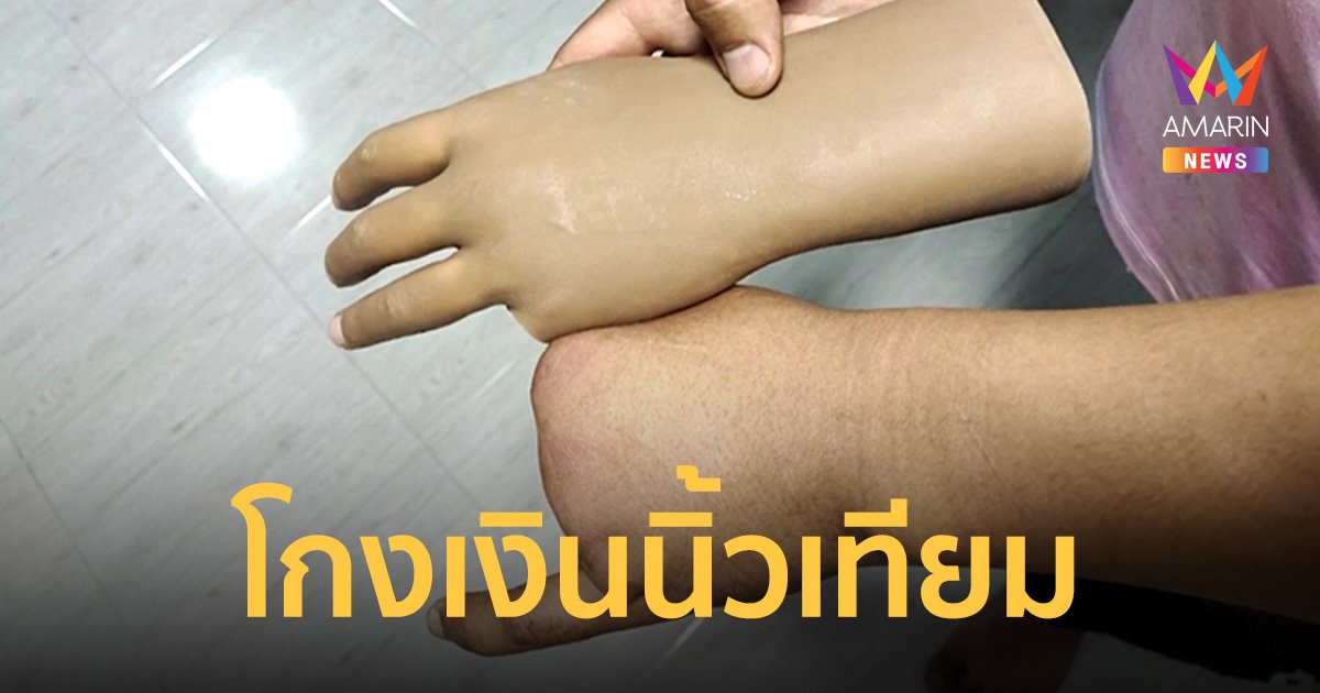 สุดช้ำ! พ่อค้านิ้วเทียมโกงเงิน 3 หมื่น รอ 3 เดือนไม่ได้ของ อ้างจำศีล
