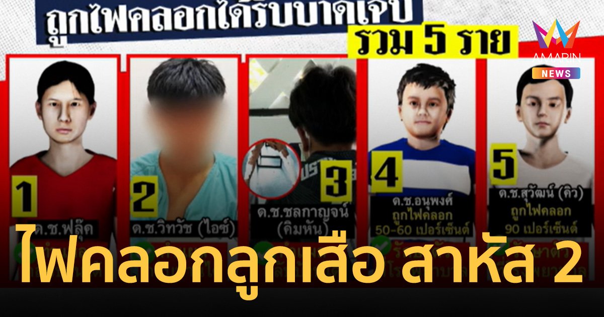 ไฟคลอกลูกเสือเข้าค่าย ขณะเตรียมแสดงซูลูขอไฟ เจ็บหนัก 2 ราย ไฟลวก 90%