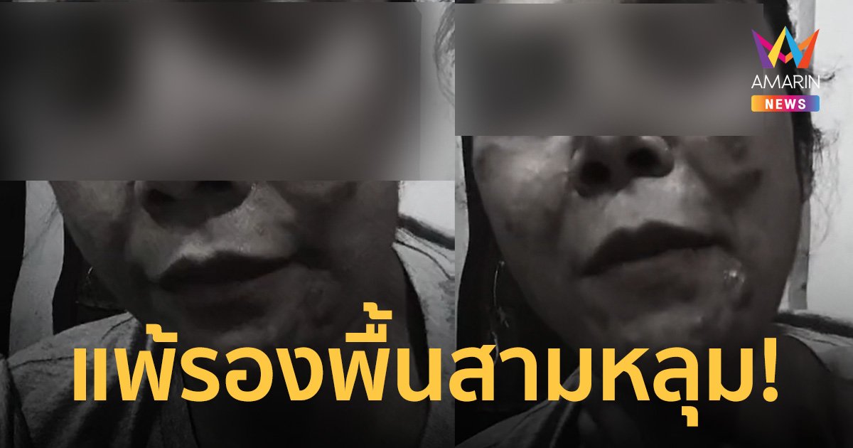 อุทาหรณ์! รองพื้น 3 ช่องร้อย สาวซื้อใช้ครั้งเดียวหน้าพังยับ รักษาเป็นเดือน