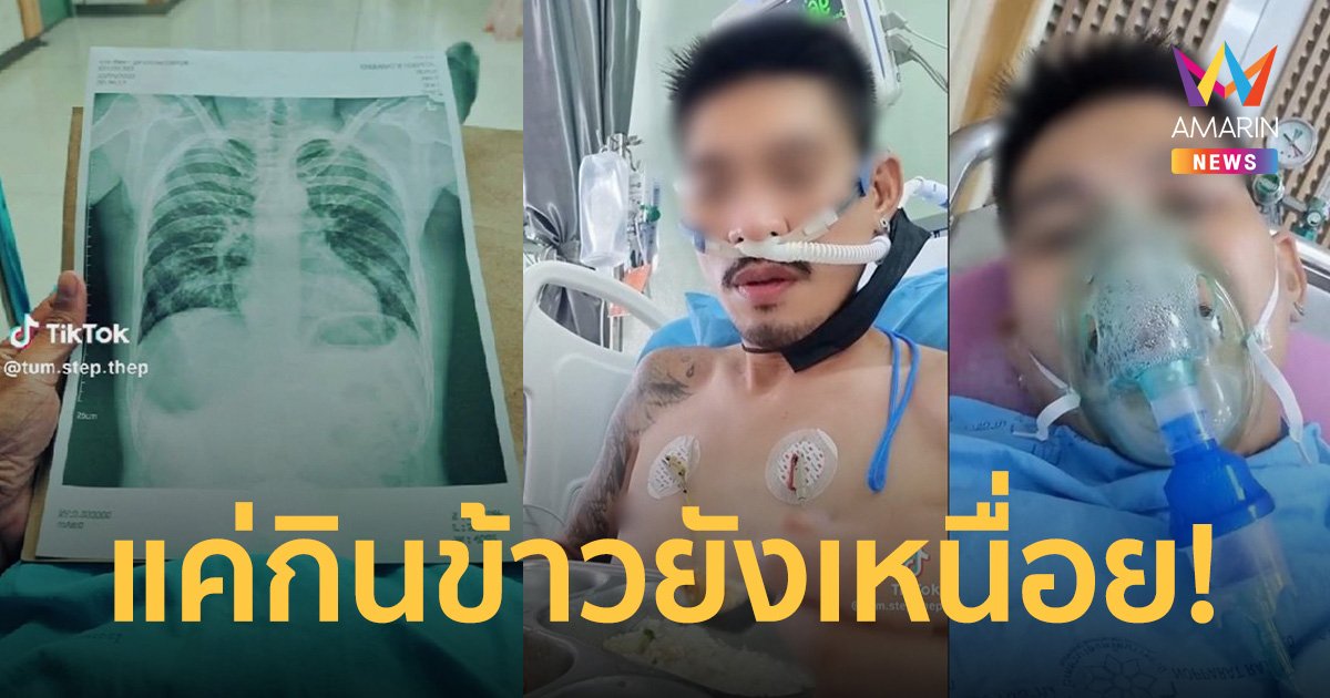 หนุ่มฝากอุทาหรณ์ สูบบุหรี่ไฟฟ้า 3 ปี ป่วยหนัก แค่กินข้าวยังหายใจไม่ทัน
