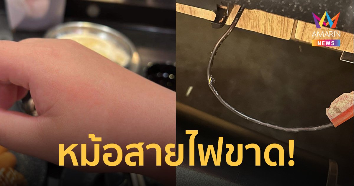 สาวแชร์อุทาหรณ์ กินชาบูโดนไฟช็อตจนร้องกรี๊ด แจ้งพนักงานได้แค่คำขอโทษ