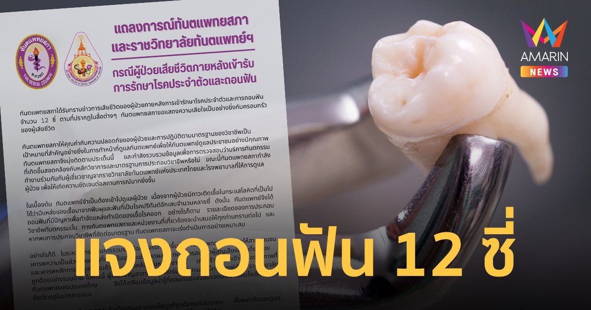 ทันตแพทยสภา แถลงข่าวลุงถอนฟัน 12 ซี่ ก่อนจะเสียชีวิต เหตุติดเชื้อในกระแสเลือด จากฟันผุ