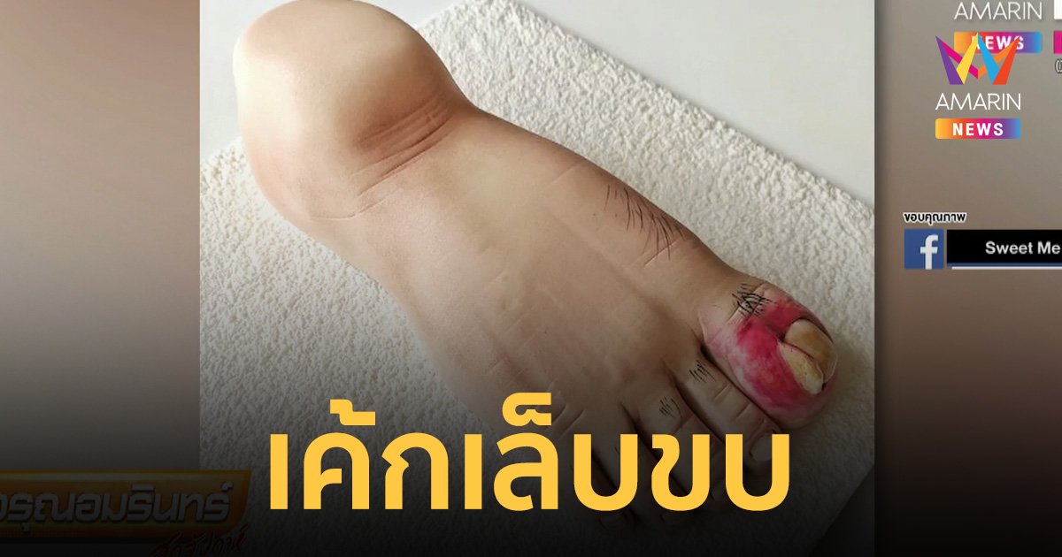 "เค้กเล็บขบ" ลูกค้าออเดอร์วันเกิดเพื่อน ร้านจัดให้ ใช้วัตถุดิบพรีเมียม