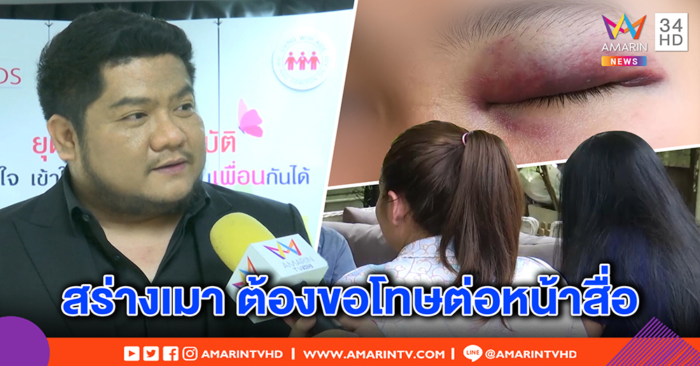 “เบน ชลาทิศ” ต่อยผู้หญิง! สาวตาเขียวเปิดใจ หวังได้คำขอโทษ เสียดายอุตส่าห์ปลื้ม (คลิป)