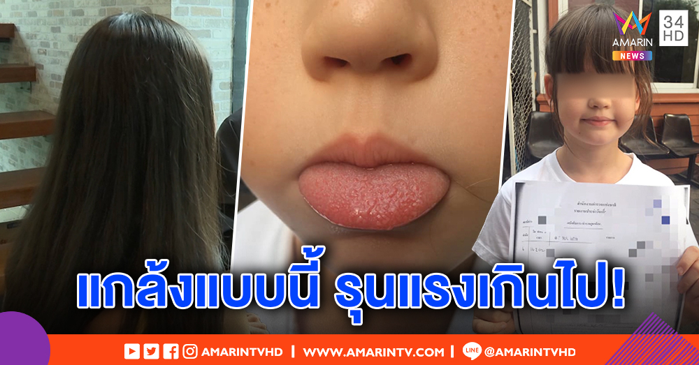 แม่เด็ก 7 ขวบช็อก! ลูกสาวถูกเพื่อนแกล้ง หลอกให้กินน้ำร้อนลวกลิ้นพอง จี้โรงเรียนใส่ใจเด็กให้มาก