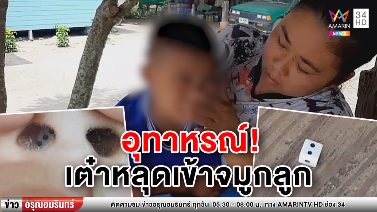 อุทาหรณ์! แม่ปล่อยลูกเล่นเกมบันไดงู ลูกเต๋าหลุดเข้าจมูก พาส่ง รพ. วุ่น (คลิป)