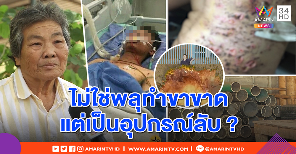 เด็กช่างถูกตัดแขนขายังไม่ฟื้น - นายจ้างยันไม่เคยใช้ทำพลุ แค่แปลงอุปกรณ์ลับทำระเบิดฉีกร่าง (คลิป)