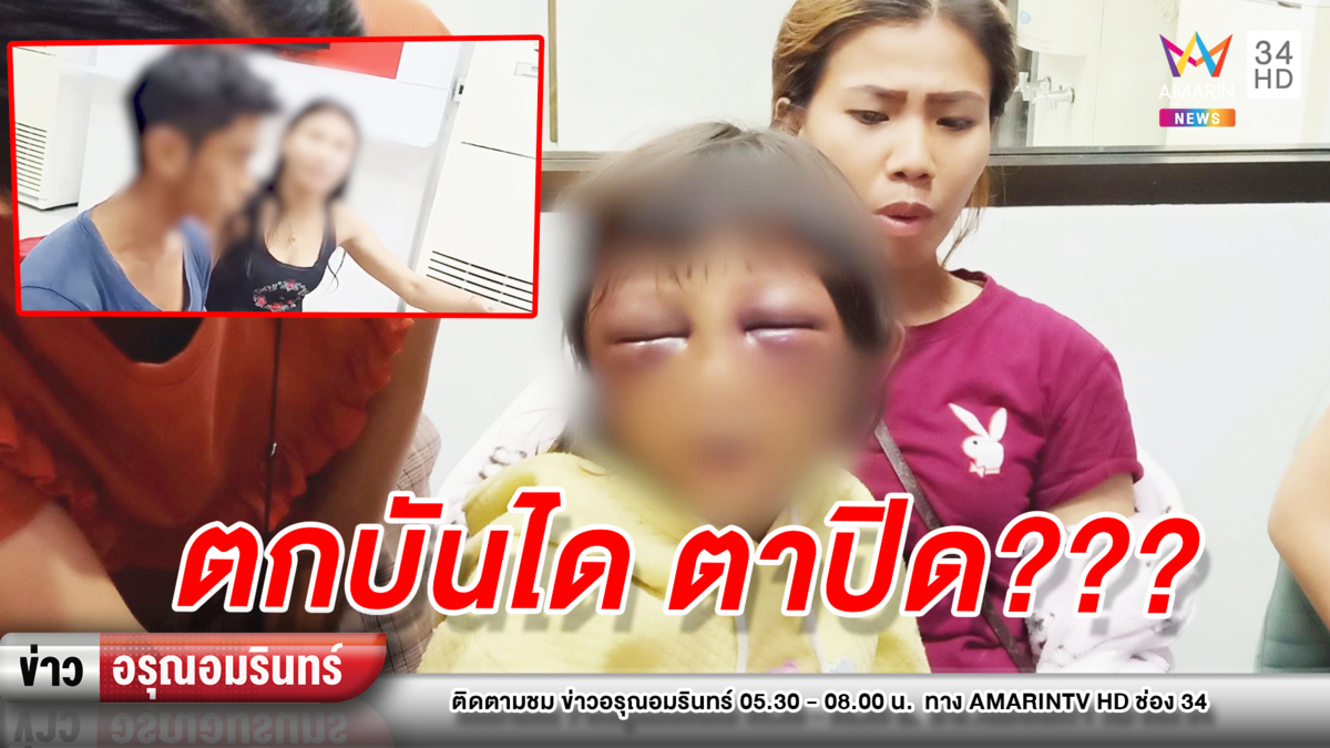 ข่าวอรุณอมรินทร์ : พ่อเลี้ยง – แม่แท้ๆ ตีลูกสาววัย 8 ขวบตาปูด