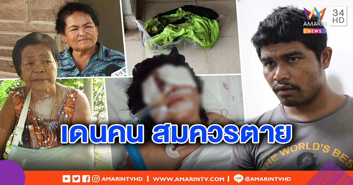 สาวถูกเผาทั้งเป็นแฉนาทีอำมหิต แฟนใหม่หวังฆ่า แม่ช็อกลูกตาบอดด้วย (คลิป)