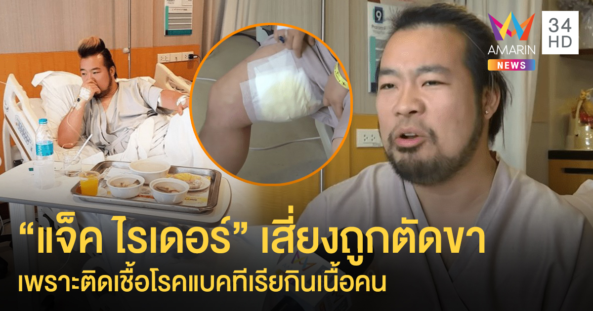 ช็อค! “แจ็ค ไรเดอร์” เสี่ยงถูกตัดขา หลังถูกแมลงที่ญี่ปุ่นกัด จนติดเชื้อโรคแบคทีเรียกินเนื้อคน