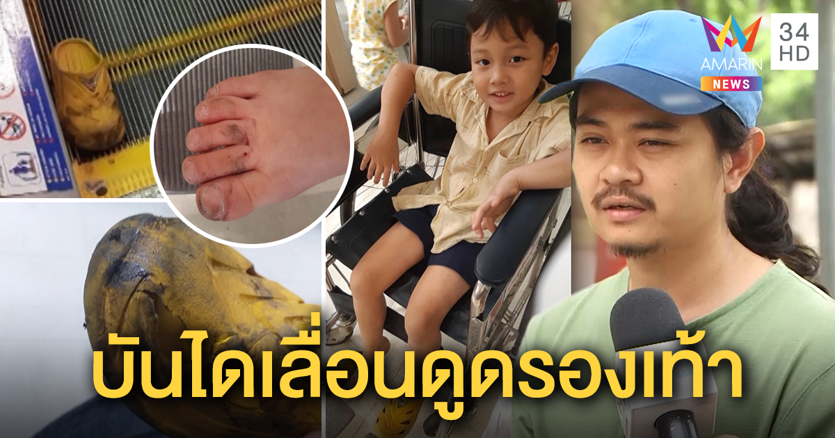 พ่อเล่านาทีระทึก ช่วยลูกชาย 5 ขวบ รองเท้าติดบันไดเลื่อน ได้แผล แนะอุ้มปลอดภัย