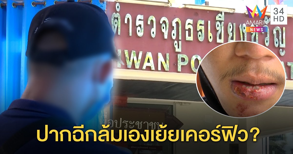 หนุ่มโชว์แผลถูกตำรวจไล่ต้อน ยิงขู่ เตะปากฉีก ตำรวจโต้ แฉกลับฝ่าเคอร์ฟิวซิ่งล้มเอง (คลิป)