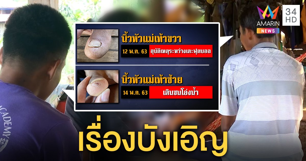 สุดบังเอิญ 2 พ่อลูก มีแผลเจ็บเท้า แจงอุบัติเหตุปัดอุ้มชมพู่ พยานยันช่วยค้นวันหาย (คลิป)