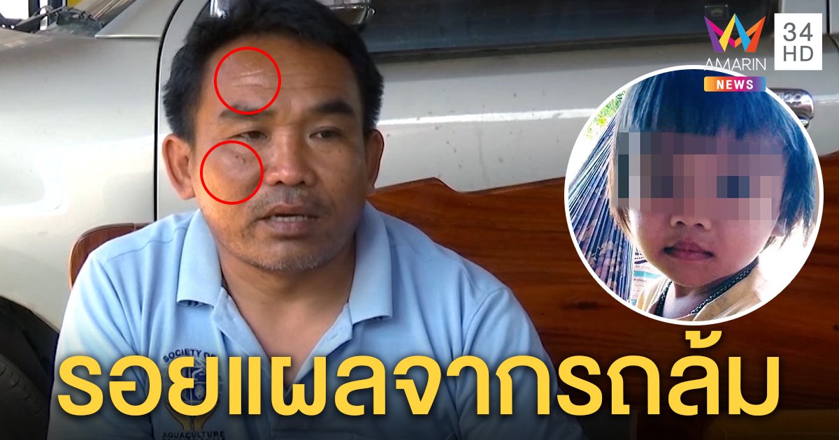 น้าเสริมแจงรอยช้ำบนหน้า ไม่ได้สู้กับชมพู่แค่แผลเป็นรถล้ม ขอโซเชียลหยุดมโน (คลิป)