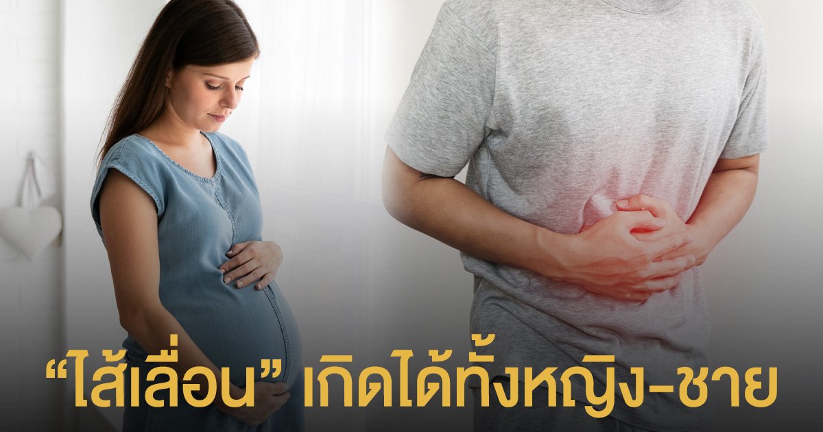 รู้ไหม...ไส้เลื่อนเกิดขึ้นได้ทั้งผู้หญิงและผู้ชาย