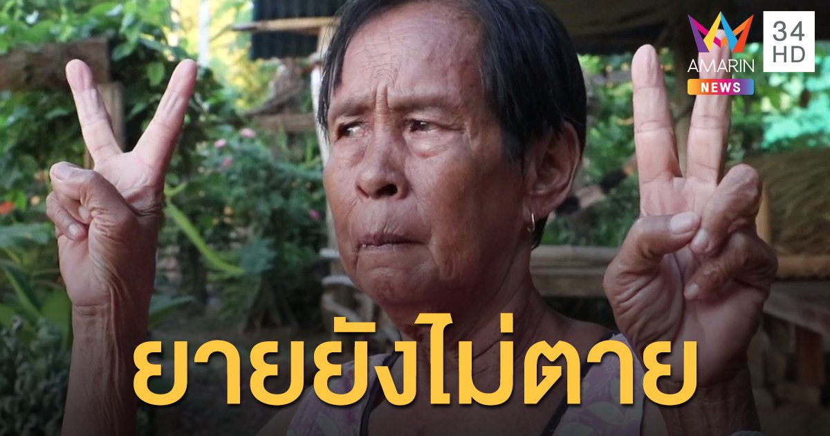 ยายชู 2 นิ้ว สยบข่าวลือ โดนผึ้งรุมต่อยจนเสียชีวิต ฝากขอบคุณคนที่ช่วยพาไปส่งหมอ