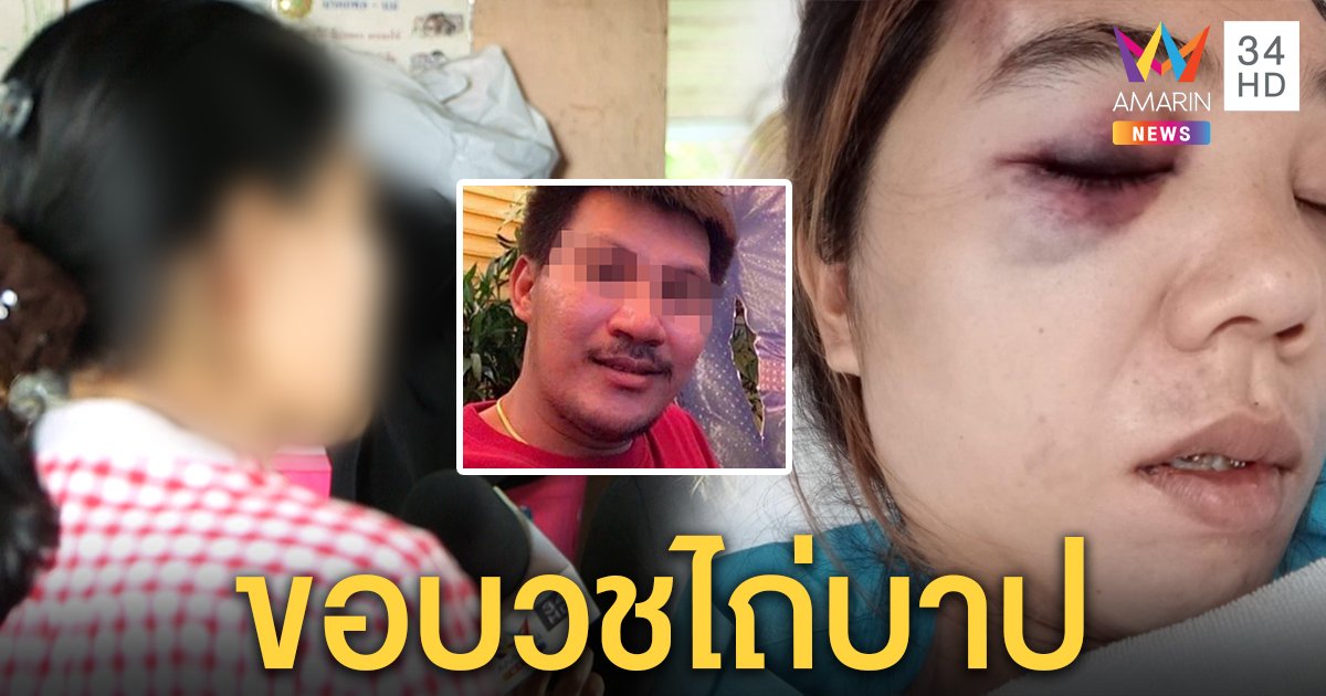 สาวโชว์แผลผัวซ้อมตาปูดเลือดคั่งสมอง แม่ผัวป้องลูกคนดี ขอเมียให้โอกาสบวชไถ่โทษ (คลิป)