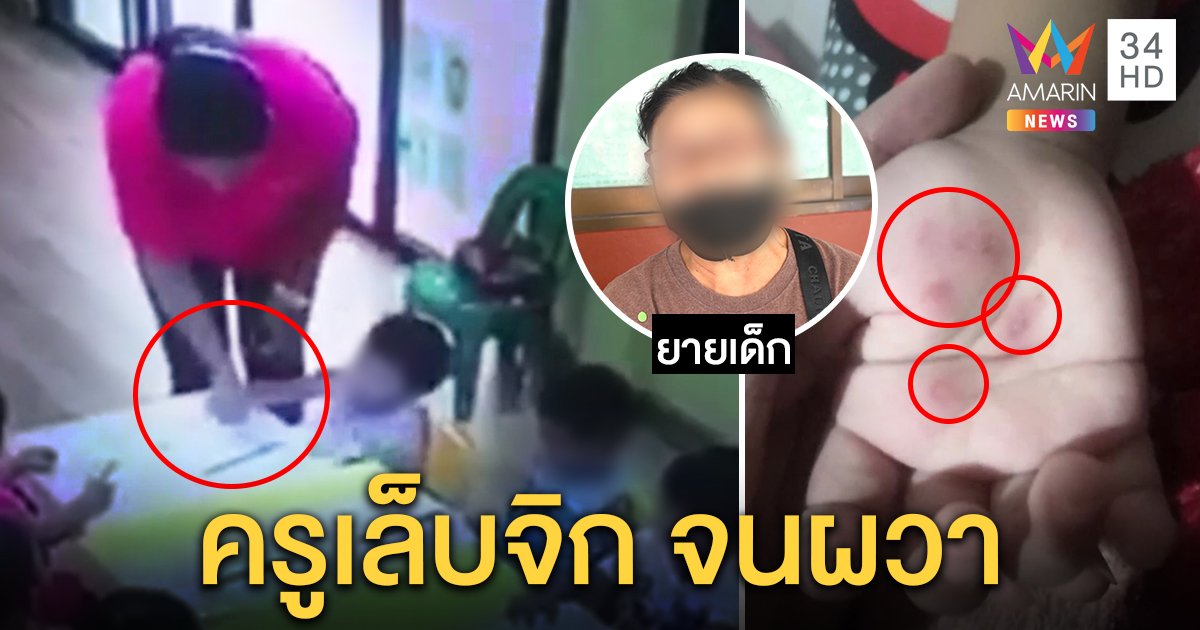 ไล่ออก! ครูพี่เลี้ยงเล็บจิกมือเด็กอนุบาล 3 ขวบ ยายลั่นไม่ยอมทำหลานผวา (คลิป)