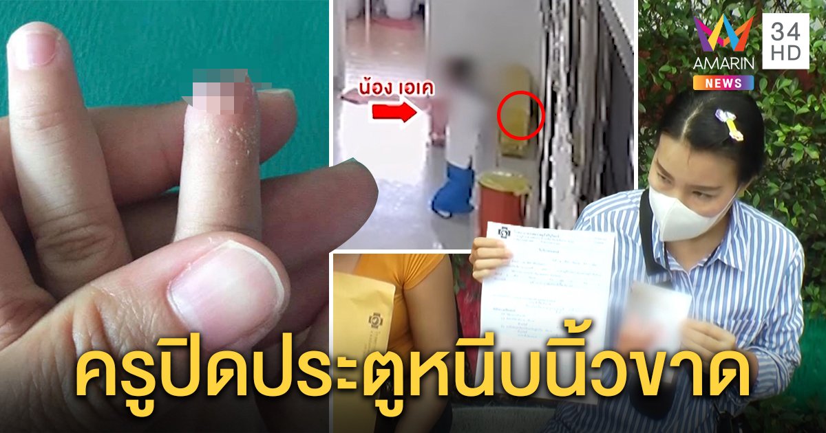 แม่ลั่นเอาผิดครูอนุบาลปิดประตูหนีบนิ้วลูกขาด อ้างลมพัด โป๊ะแตกภาพมัดผิด (คลิป)