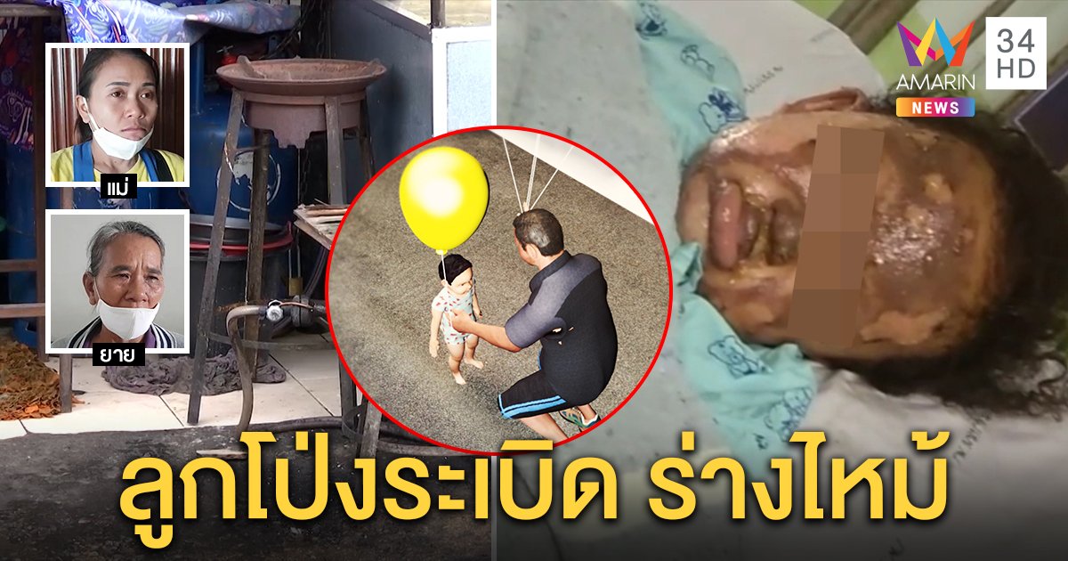 แม่ช้ำใจ ลูกโป่งอัดแก๊สระเบิดใส่หลาน 2 ขวบร่างไหม้ คนขายยัดใส่มือทำเมิน (คลิป)