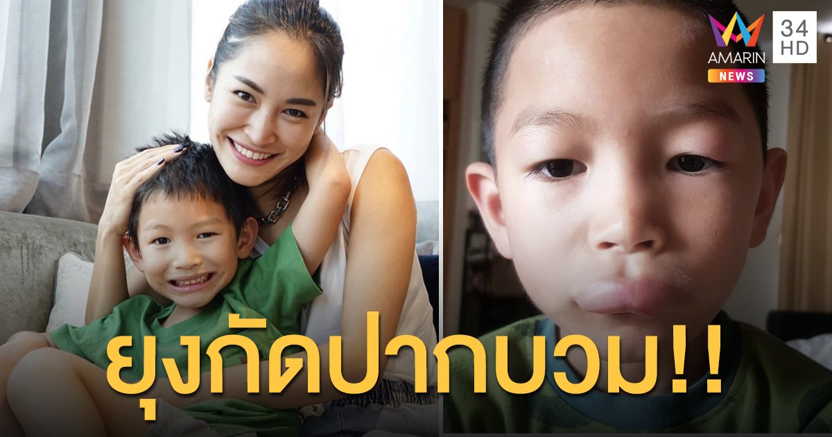 “พลอย พลอยพรรณ” ตกใจ!! “น้องพูม่า” ลูกชายถูกยุงกัดปากบวมเป่ง!!