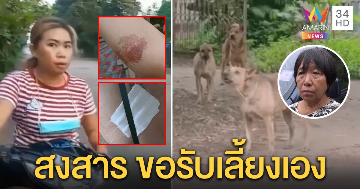 คนรักสัตว์ป้อง 4 หมากัดสาวไม่ดุขอรับเลี้ยง เหยื่อโผล่แฉถูกงับ 3 รอบขาเหวอะ (คลิป)