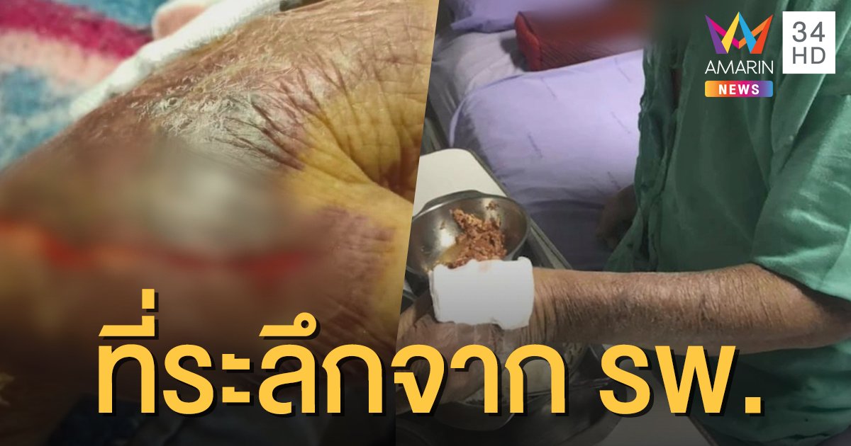 โวย! พนักงาน รพ.ดังในเชียงใหม่ กระชากแขนคนไข้วัยชราจนหนังฉีก